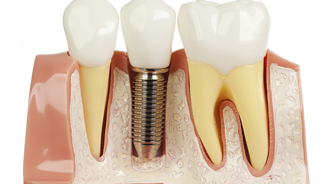 5 истини за базалните зъбни импланти